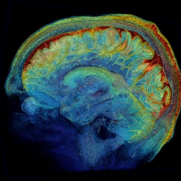 Mapping the Brain